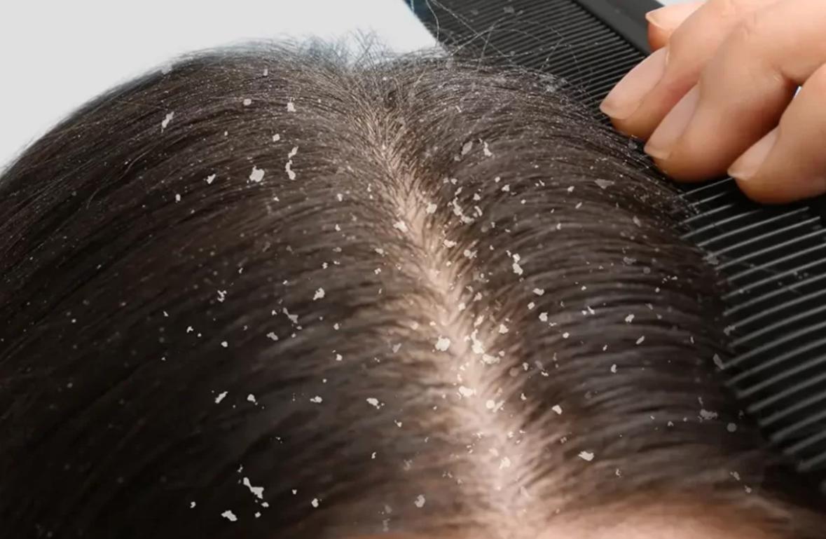 KettWell Hair and Scalp Clinic